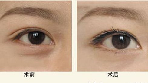 樂山人民醫(yī)院醫(yī)生特色項(xiàng)目與服務(wù)評價(jià)全解析