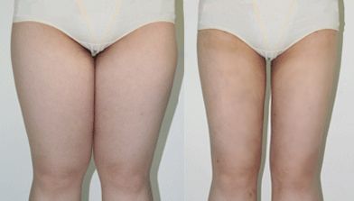 天津口腔整形醫(yī)院推薦，去除笑露齦的好選擇