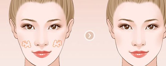 濟(jì)南整形醫(yī)院推薦：權(quán)威醫(yī)院排名及口碑比較