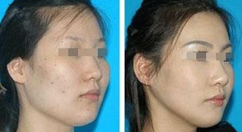 上海優(yōu)質(zhì)美容醫(yī)院盛行，曙光醫(yī)院和長海醫(yī)院卓越實(shí)力受矚目！速來查看！