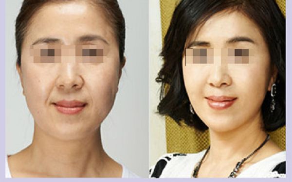 溫州哪家整形醫(yī)院口碑好？排名榜單揭曉