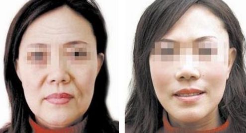 洛陽整容醫(yī)院排名與評(píng)價(jià)