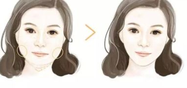 大連市哪些醫(yī)院是專(zhuān)業(yè)的開(kāi)眼角整形中心？