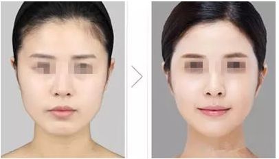 武漢治療色斑好的醫(yī)院推薦，哪家效果好呢？