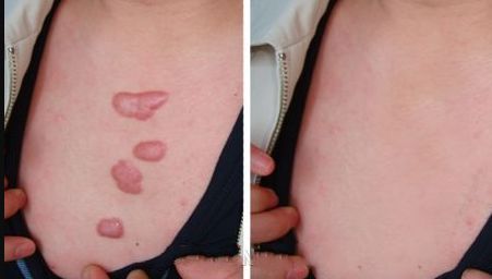 北京有哪些三甲級美容醫(yī)院？