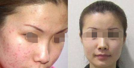 珠海優(yōu)質(zhì)豐臀修復(fù)醫(yī)院排行榜