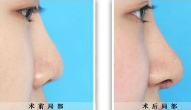 臨汾臻容醫(yī)療美容門診部詳解：技術水平、服務項目與價格清單