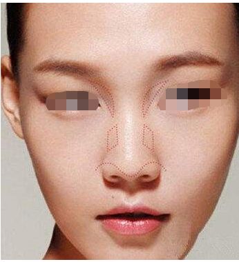 泉州哪些醫(yī)院可以信賴進行整形手術(shù)？