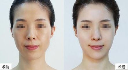 深圳美萊整形醫(yī)院位置介紹，牽手醫(yī)生，搶先體驗(yàn)熱門項(xiàng)目