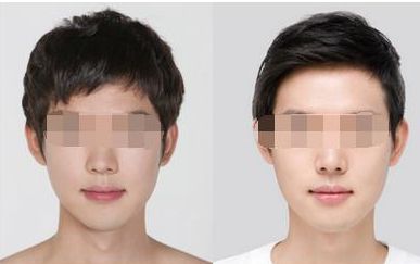 汕頭知名醫(yī)美機構(gòu)排行榜大揭秘，你知道嗎？