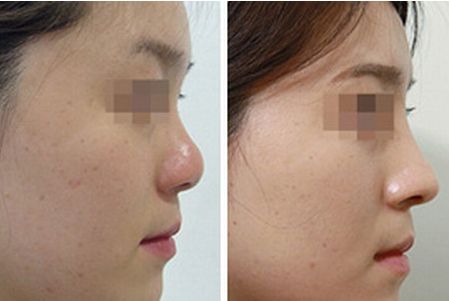 珠海香洲區(qū)哪家整形醫(yī)院專業(yè)靠譜？