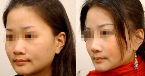 無(wú)錫市最好的私密整形醫(yī)院推薦名單