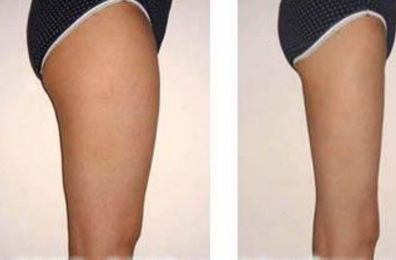 沈陽(yáng)正規(guī)整容醫(yī)院熱門榜單來襲！專家推薦的百嘉麗、杏林磐石排名高位