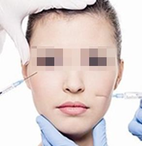 順產(chǎn)公司榜單排名，你一定要看的玻尿酸醫(yī)院選購指南！