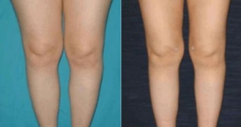 答案：  浙江哪個醫(yī)院的燒傷整形科醫(yī)護人員規(guī)模龐大？