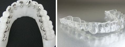 杭州有哪些紋身醫(yī)院排行榜，前三大發(fā)現(xiàn)！