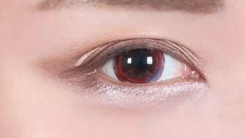 中南大學(xué)湘雅醫(yī)院眼袋整形揭秘：專家團(tuán)隊(duì)、手術(shù)解析