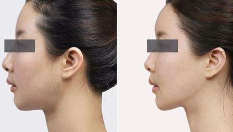 綿陽市哪家醫(yī)院整形效果好？整形醫(yī)院排名榜前十名出爐！