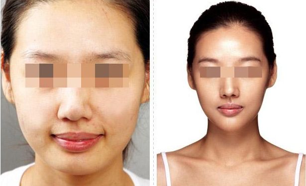 上海下巴整形哪家專業(yè)可信？