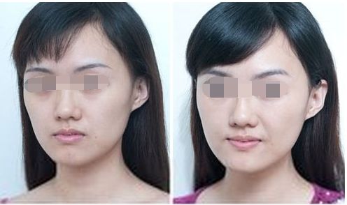 中山整形醫(yī)院八強名單公開！看看這些優(yōu)質(zhì)醫(yī)院是否入選受關注！