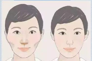 雙眼皮術(shù)后護(hù)理全攻略：埋線和全切有何異同？多久恢復(fù)自然？