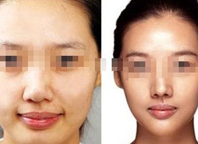 女星蠟像面容成災(zāi)，孫菲菲領(lǐng)銜瘦臉狂潮