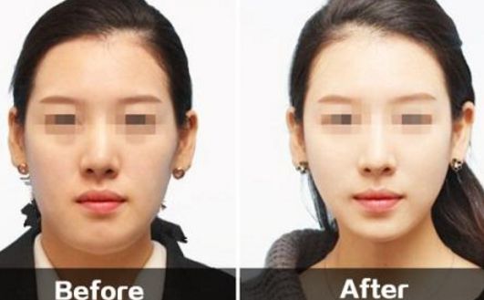 昆明哪里可以進(jìn)行理想的雙眼皮整形手術(shù)？