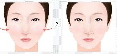 杭州疤痕整形醫(yī)院排名前五大全揭秘