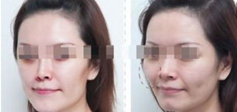 杭州整形美容醫(yī)院排名前六，你值得了解的每一家！