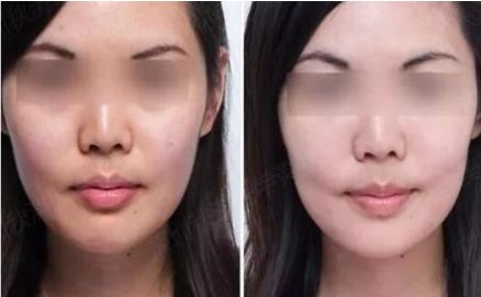 蚌埠最優(yōu)選！第一人民醫(yī)院整形科醫(yī)生名單公開，四月價(jià)格表持續(xù)更新！