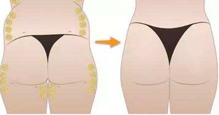 北京雙眼皮價(jià)格大全，口碑醫(yī)生推薦，預(yù)約指南