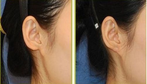 大慶拉皮手術好口碑醫(yī)院推薦：用戶真實評價分享！