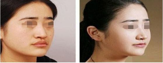 昆明哪家整形醫(yī)院好評(píng)較多的名單大揭秘