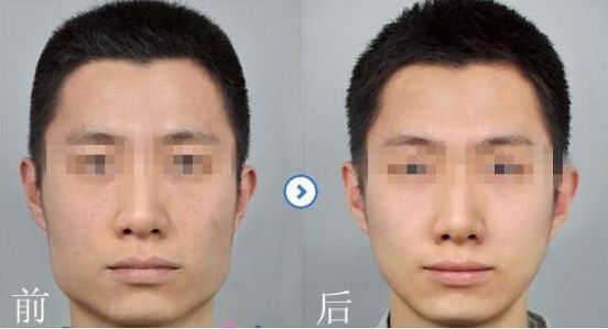 2024寧波注射自體脂肪醫(yī)院排行榜，就在這里發(fā)現(xiàn)比較好的選擇！