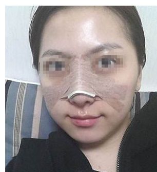 長(zhǎng)春哪家醫(yī)療機(jī)構(gòu)技術(shù)受認(rèn)可，雙眼皮整形實(shí)效較顯著