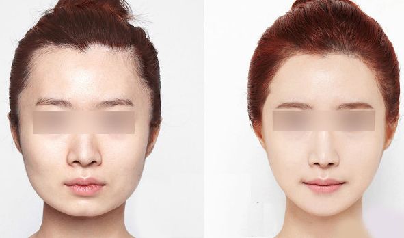 西安藝星醫(yī)療美容醫(yī)院2023年價格一覽：了解醫(yī)療美容服務(wù)費用信息，醫(yī)生簡介待查！