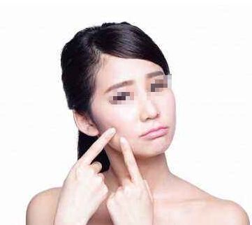 蚌埠哪家整形醫(yī)院雙眼皮效果比較好？