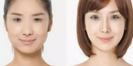 阜陽比較好的鼻子醫(yī)院在哪里