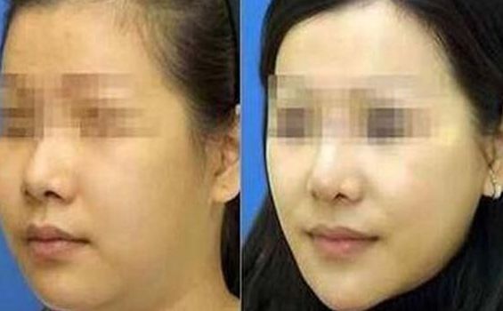 西昌愛麗諾醫(yī)療整形美容醫(yī)院綜合實(shí)力如何