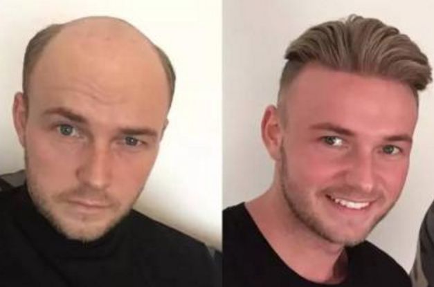 大同市第三人民醫(yī)院皮膚美容科收費及醫(yī)生介紹