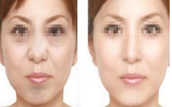 惠州整容醫(yī)院評價(jià)top10