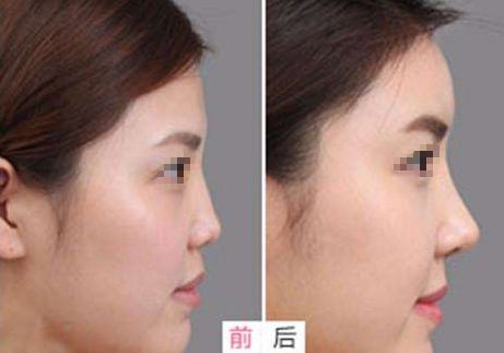 重慶小柯麗格口碑揭秘：權(quán)威機(jī)構(gòu)認(rèn)證，美麗蛻變首選