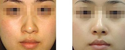 高州市人民醫(yī)院皮膚科實力分析：價格透明，醫(yī)生技術(shù)精湛