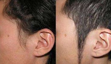 隆胸與自然胸的區(qū)別：觸感對比