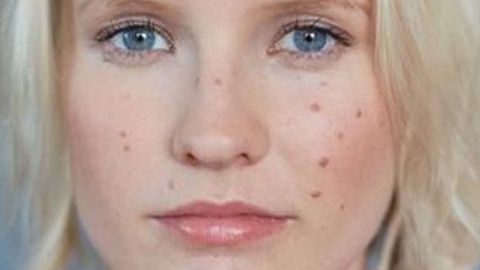 重慶中醫(yī)院整形科：專家推薦的優(yōu)秀項(xiàng)目及豐富醫(yī)院科室醫(yī)生信息！