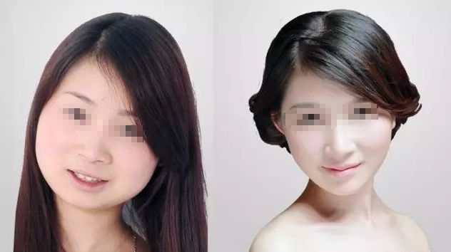 成都藝星何林：打造自然大方雙眼皮，3位顧客口碑爆棚