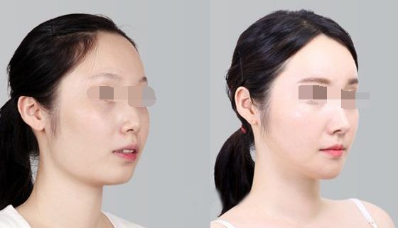 浙江整形外科醫(yī)院排行榜出爐，引領(lǐng)美麗新風(fēng)尚！