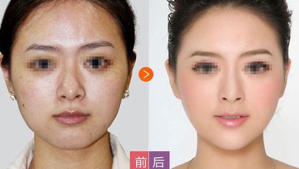 邢臺博愛高健整容致命嗎？高健整容水平值得信賴！