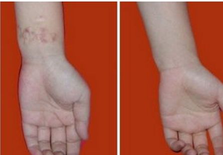 邯鄲市人民醫(yī)院整形科：2023年價目公示，獨特服務(wù)一覽