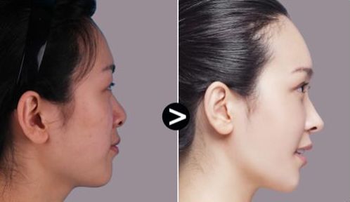 西安哪家整形醫(yī)院匯總排名前十？專業(yè)權威醫(yī)院推薦！